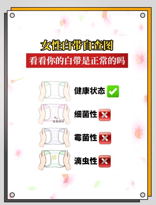 孕期白带豆腐渣状是否正常？需警惕哪些感染风险？如何安全应对？-第1张图片-郑州医学网