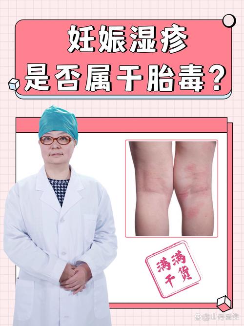 怀孕期间为何总被湿疹缠上？孕期湿疹的诱因与应对方法有哪些？-第2张图片-郑州医学网