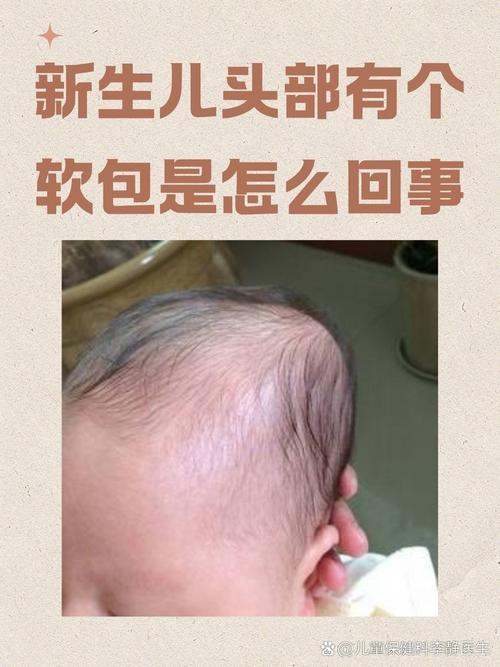 新生儿小鸡头红肿图片显示异常情况，需要警惕哪些潜在健康问题？-第3张图片-郑州医学网