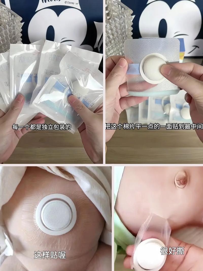 新生儿肚脐贴到底该买多少张才够用？-第2张图片-郑州医学网