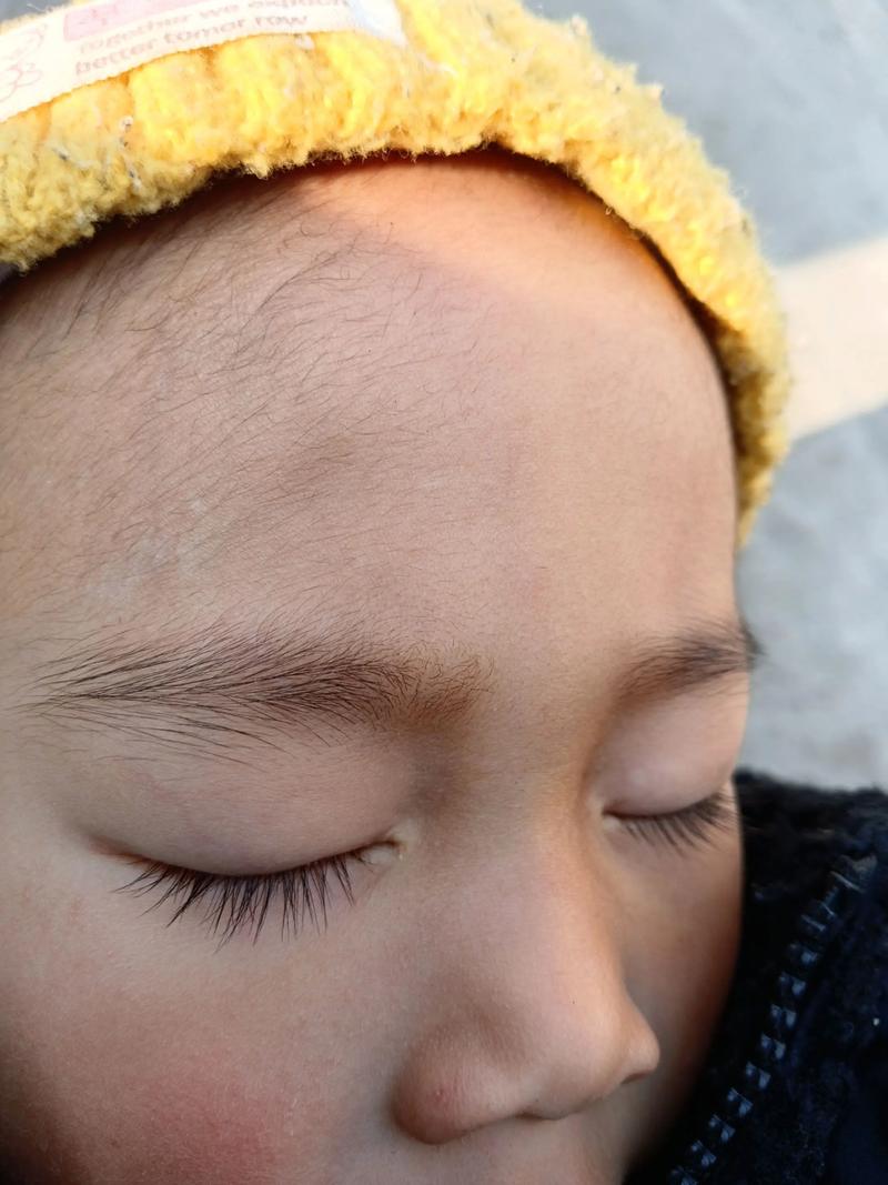 新生儿误食大量绒毛会有危险吗？如何处理和预防？-第1张图片-郑州医学网