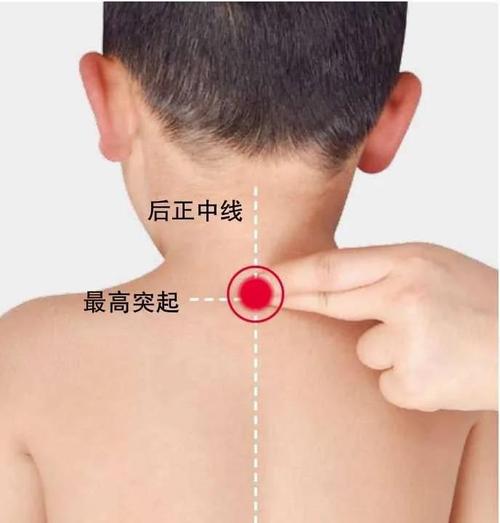 儿童大椎的准确位置图-第1张图片-郑州医学网