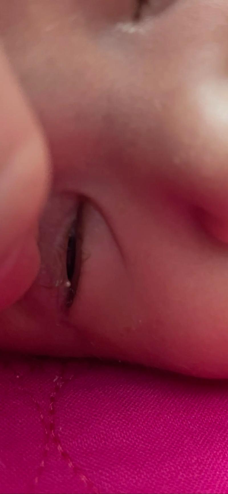 新生儿眼角出现白色泡泡是正常现象还是疾病信号?-第1张图片-郑州医学网 新生儿眼角出现白色泡泡是正常现象还是疾病信号?-第1张图片-郑州医学网