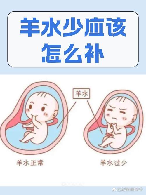 怀孕期间羊水少，饮食调理和医疗干预哪个更有效？-第3张图片-郑州医学网