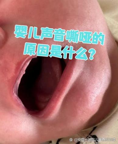 新生儿睡觉嗓子有声音是正常现象还是健康隐患？需关注哪些潜在问题？-第2张图片-郑州医学网