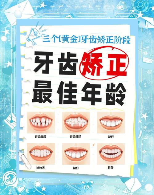 儿童牙齿矫正最佳年龄-第1张图片-郑州医学网 儿童牙齿矫正最佳年龄-第1张图片-郑州医学网