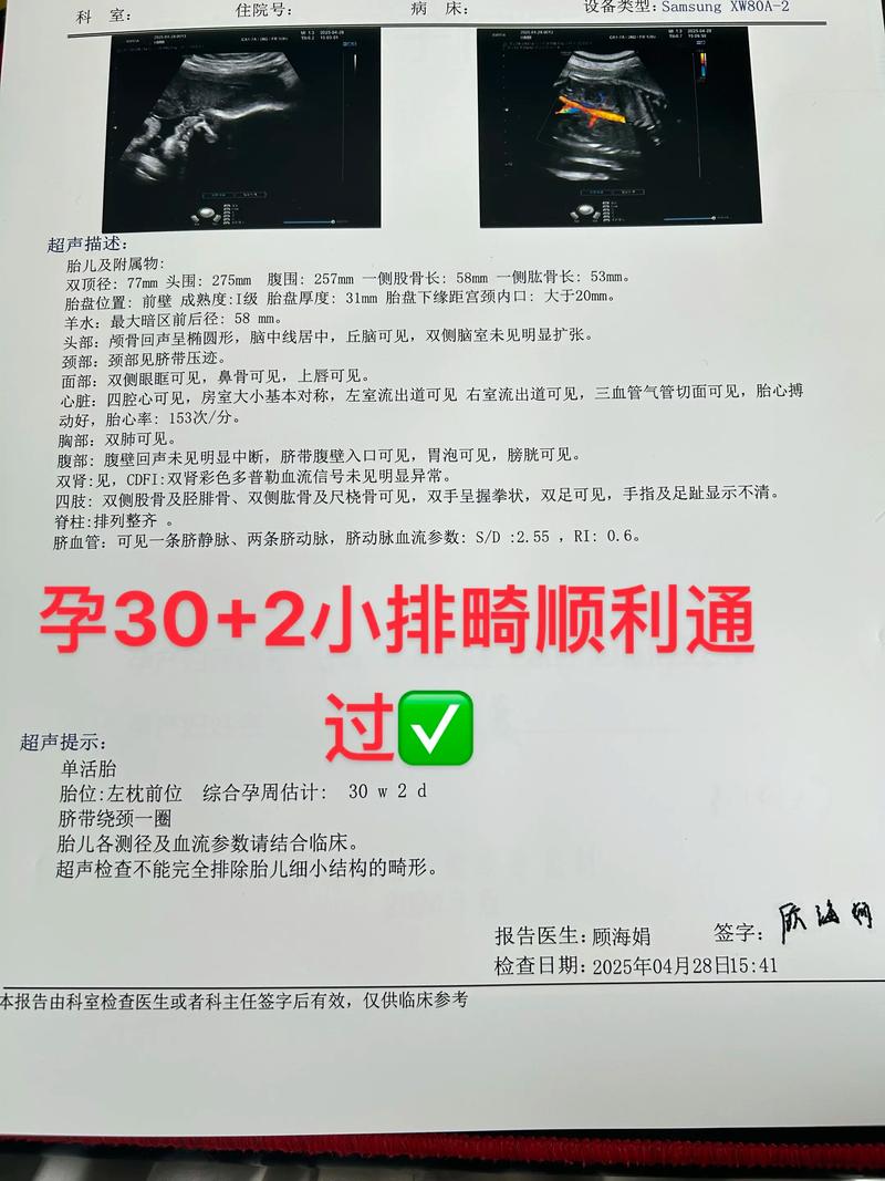 孕期排畸检查能否准确发现胎儿六指畸形？存在哪些影响因素？-第1张图片-郑州医学网
