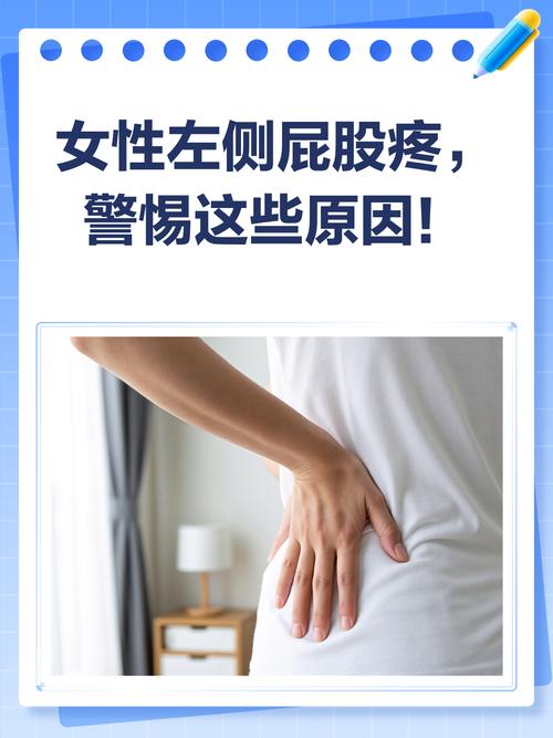 孕期左侧屁股痛是压迫神经还是缺钙？怎么缓解才安全？-第2张图片-郑州医学网