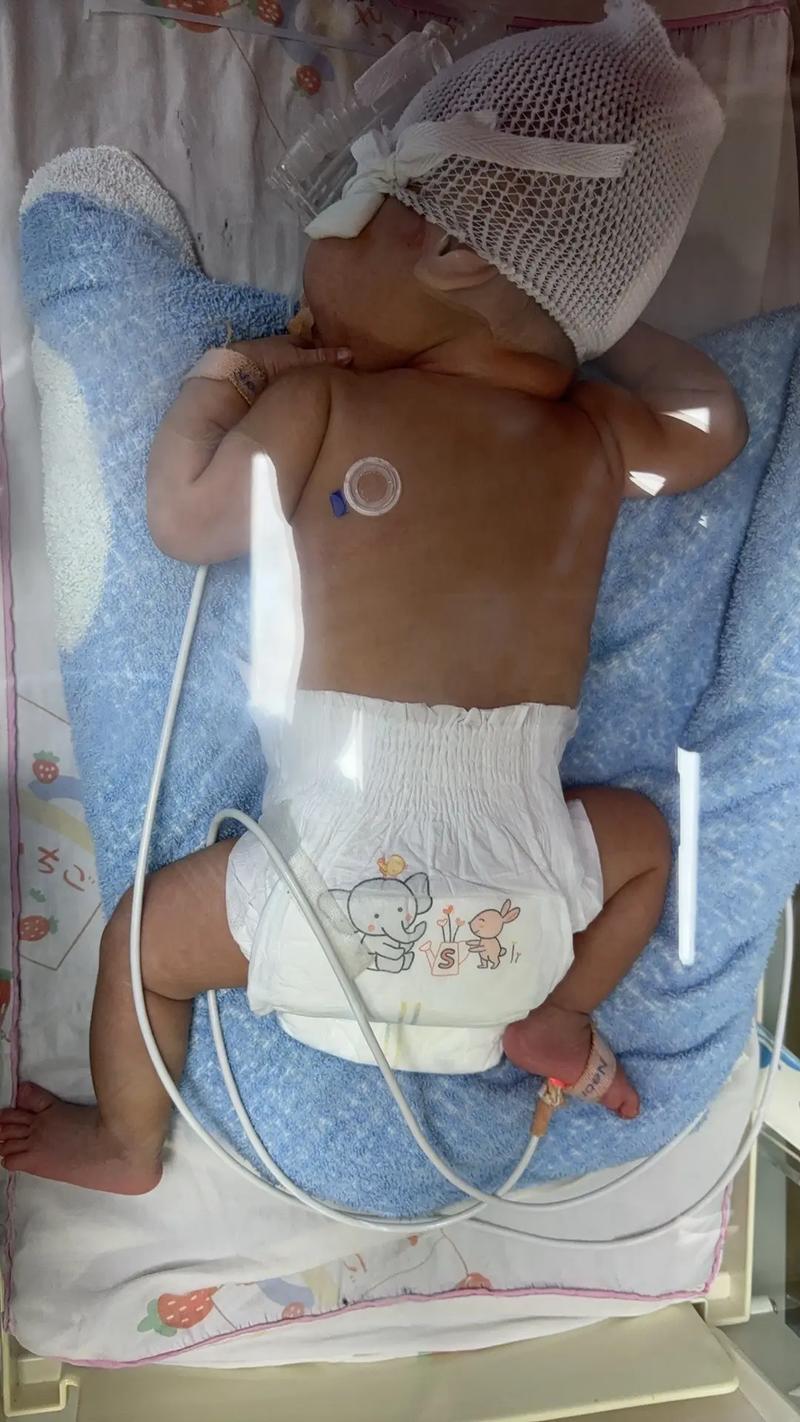 新生儿钡灌肠造影检查，这项检查安全吗？宝宝会痛苦吗？家长需要做哪些准备？-第2张图片-郑州医学网