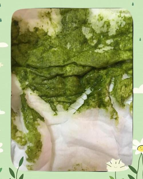 新生儿喝奶粉后大便发绿，是奶粉不适应还是喂养方式有问题？-第1张图片-郑州医学网