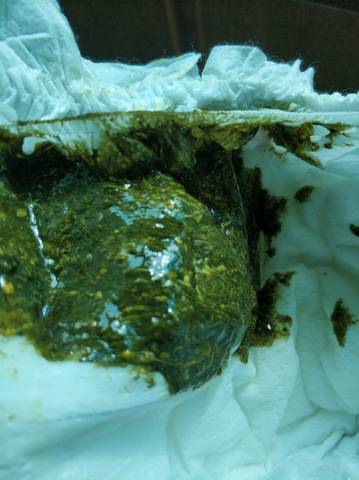 新生儿喝奶粉后大便发绿，是奶粉不适应还是喂养方式有问题？-第2张图片-郑州医学网