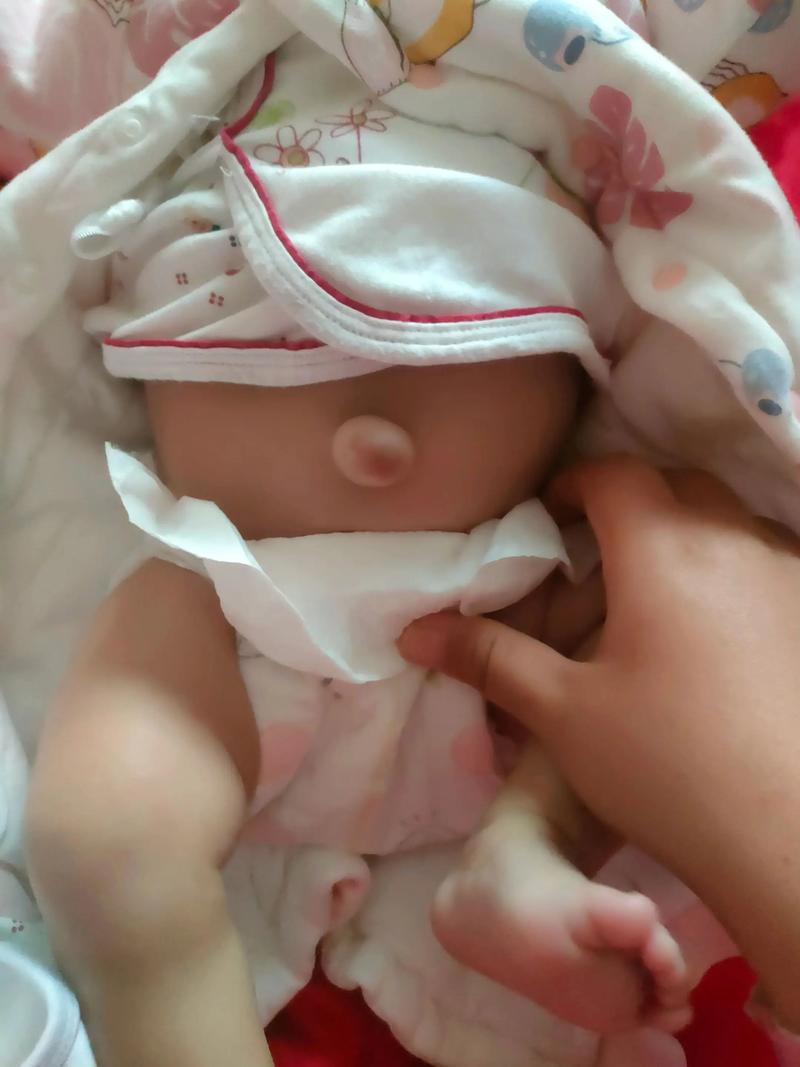 新生儿肚子青筋明显是正常现象吗？图片显示这种情况需要担心吗？-第1张图片-郑州医学网