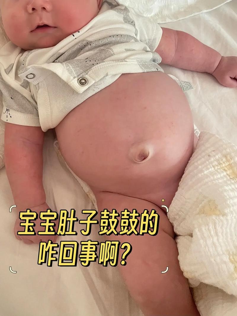 新生儿肚子青筋明显是正常现象吗？图片显示这种情况需要担心吗？-第3张图片-郑州医学网