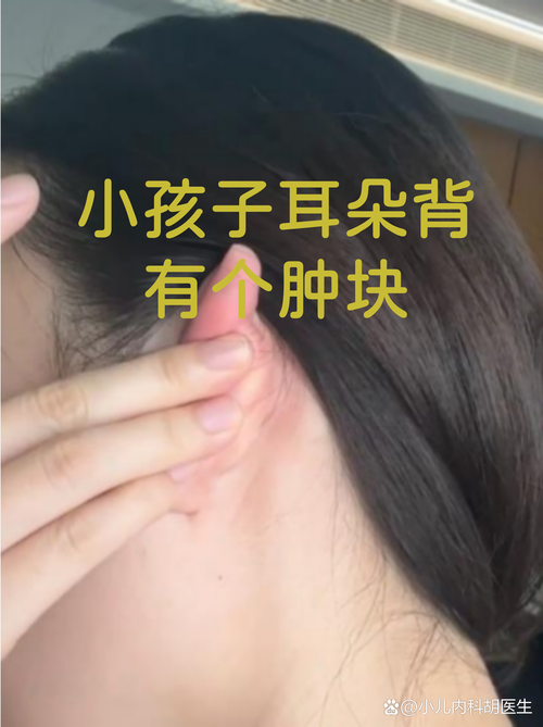 儿童耳后淋巴结肿大图，正常与异常的界限在哪里？需警惕哪些疾病信号？-第1张图片-郑州医学网