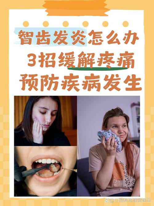 备孕期间长智齿到底能不能拔?会不会影响怀孕和胎儿健康?-第3张图片-郑州医学网 备孕期间长智齿到底能不能拔?会不会影响怀孕和胎儿健康?-第3张图片-郑州医学网