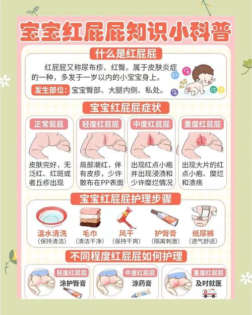 新生儿红屁股反反复复怎么办？如何有效护理才能快速好？-第2张图片-郑州医学网