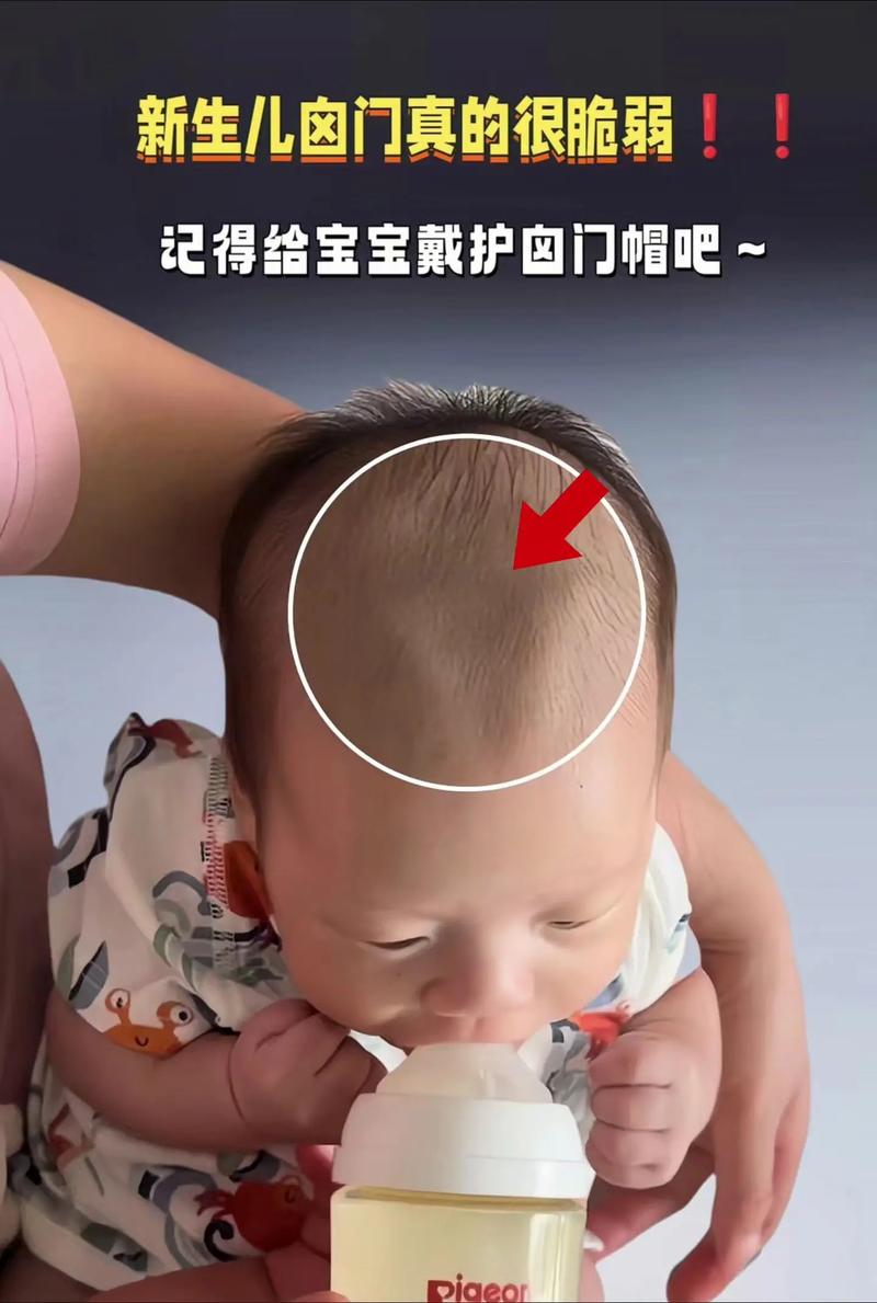 新生儿头部散热差，戴帽子能保暖防冷？还是另有健康防护关键？-第2张图片-郑州医学网