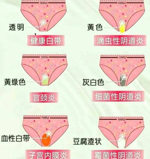 孕期外阴瘙痒分泌物多，是正常孕期反应还是妇科感染预警？-第2张图片-郑州医学网