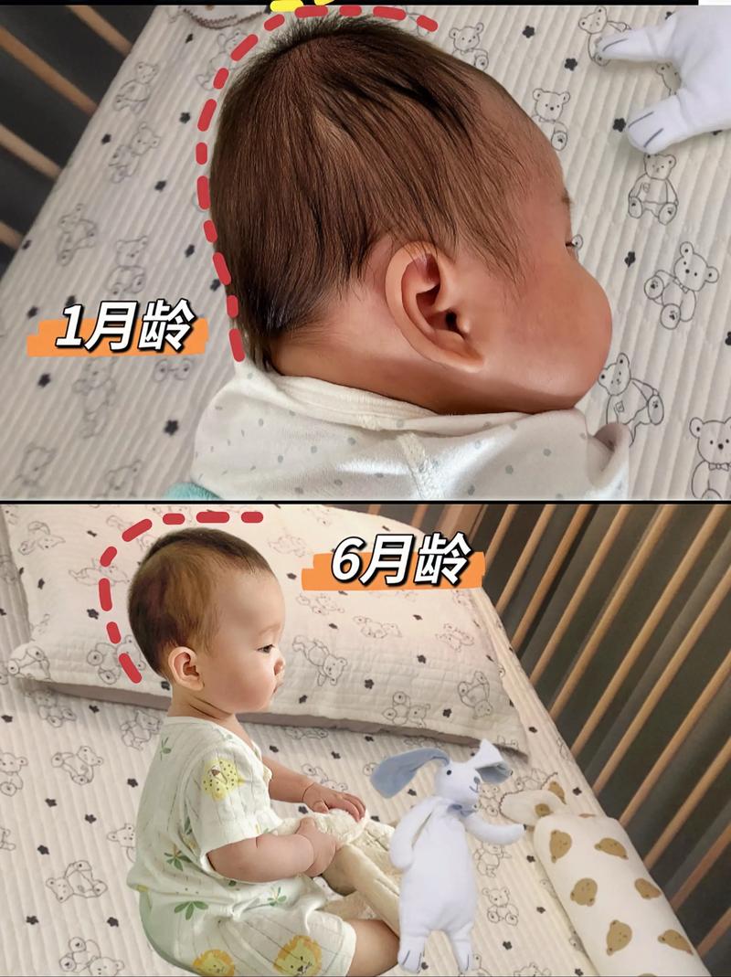 新生儿睡觉脑袋左右晃-第2张图片-郑州医学网