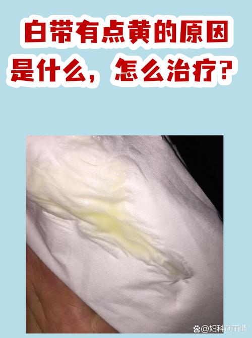 孕期白带发黄是正常现象吗？需要警惕哪些异常情况？-第2张图片-郑州医学网