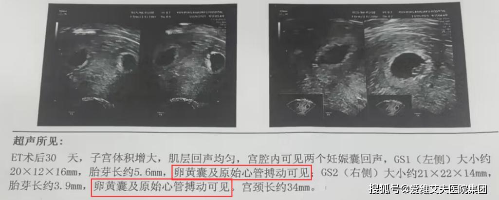 孕期做7次B超真的有必要吗？会对胎儿有影响吗？-第1张图片-郑州医学网