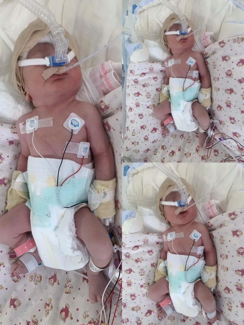 新生儿意外死亡常见原因有哪些？家长该如何有效预防这些悲剧发生？-第1张图片-郑州医学网