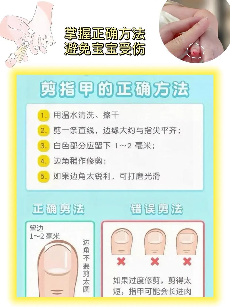新生儿多久可以剪指甲？剪指甲时需要注意哪些细节？-第2张图片-郑州医学网