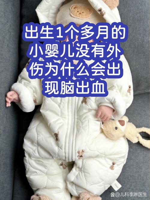 新生儿脑轻微出血是普遍现象吗？会对发育有影响吗？-第3张图片-郑州医学网