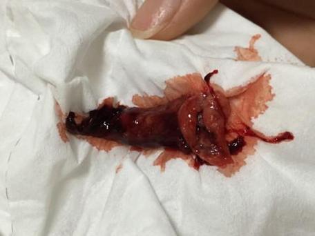 怀孕时梦见流产，是身体预警还是心理压力的投射？-第1张图片-郑州医学网