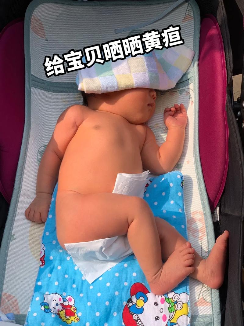 新生儿黄疸嗜睡是病情加重的信号吗？家长该如何判断与应对？-第1张图片-郑州医学网
