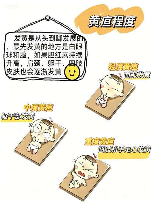 新生儿黄疸嗜睡是病情加重的信号吗？家长该如何判断与应对？-第3张图片-郑州医学网
