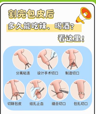 儿童包茎手术到底几岁做最合适？早了有风险，晚了会影响发育吗？-第1张图片-郑州医学网