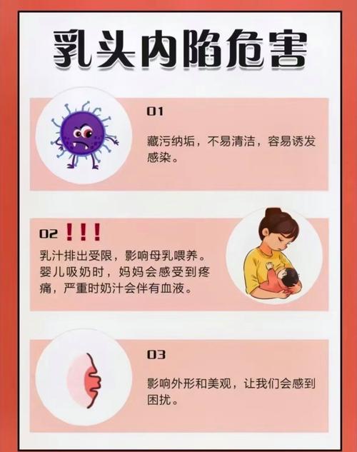 孕期乳头凹陷会影响哺乳吗？需要提前矫正吗？有哪些安全有效的处理方法？-第2张图片-郑州医学网