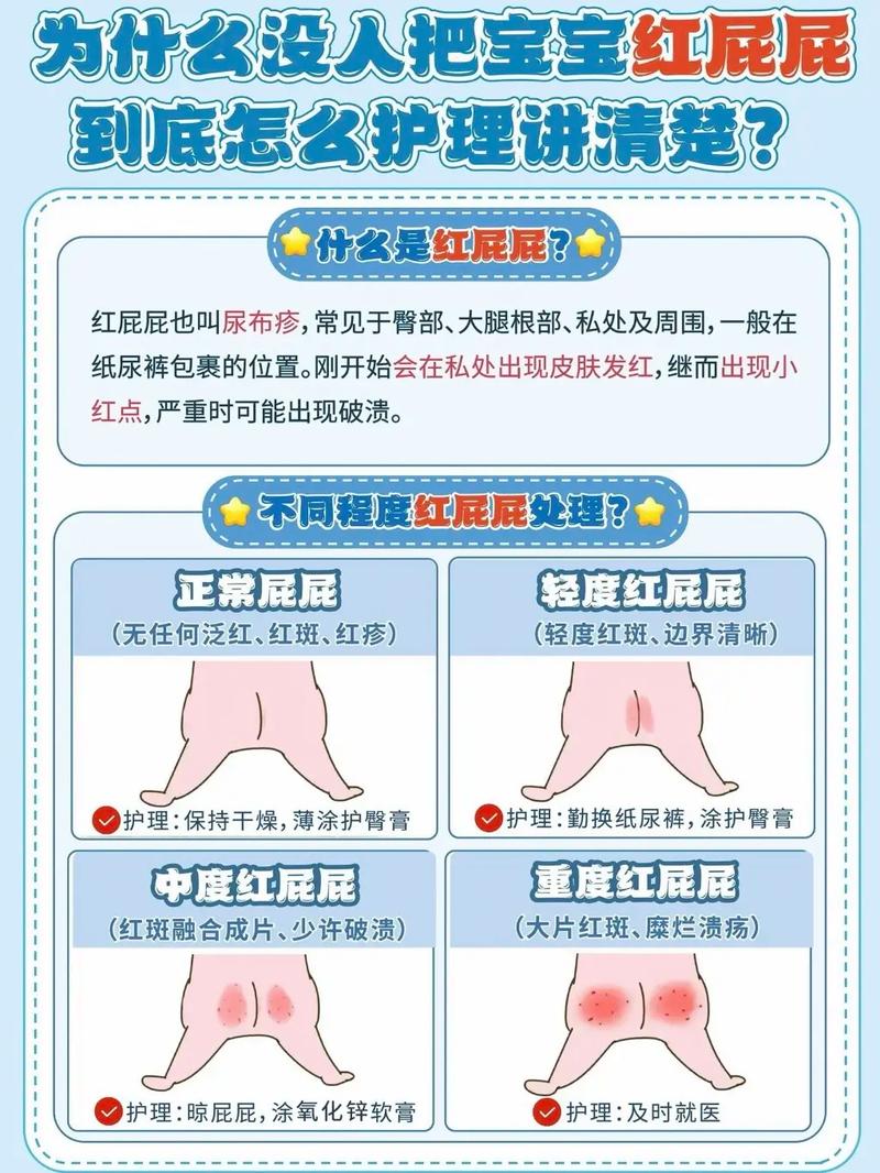 新生儿屁屁红反反复复，到底怎么护理才能好得快又不伤皮肤？-第3张图片-郑州医学网