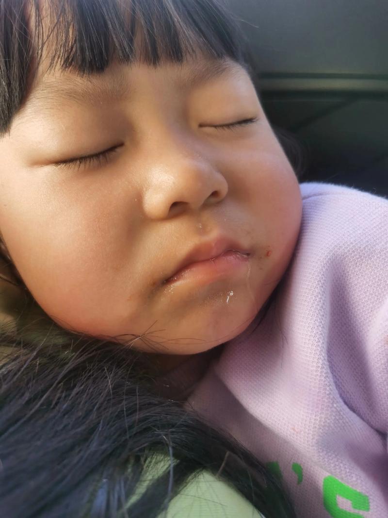 新生儿睡觉嗓子总发出吼吼声，是正常现象还是呼吸道问题？-第1张图片-郑州医学网