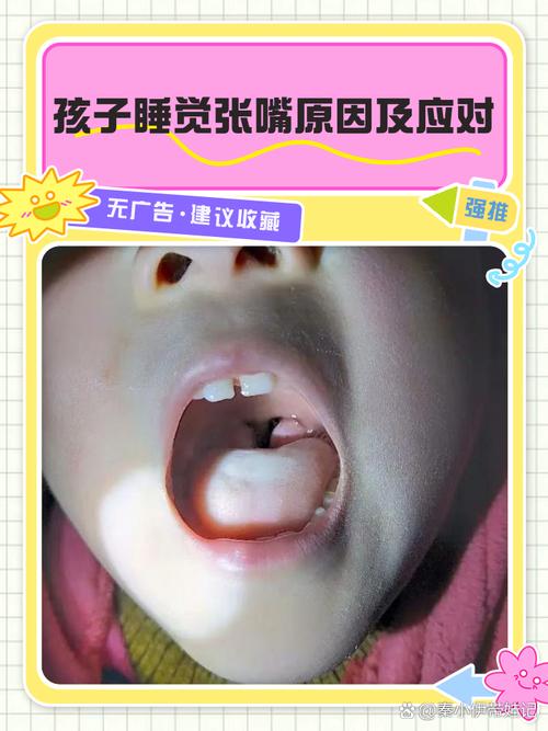 新生儿睡觉嗓子总发出吼吼声，是正常现象还是呼吸道问题？-第2张图片-郑州医学网