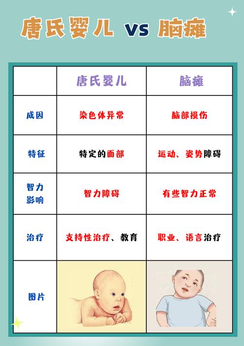 新生儿出生后多久能进行脑瘫筛查？早期筛查的最佳时间点是什么？-第2张图片-郑州医学网