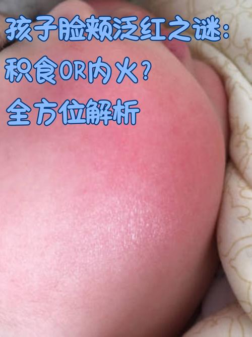 新生儿大便时满脸通红是正常现象还是身体不适信号？-第2张图片-郑州医学网
