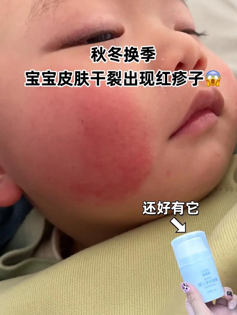 新生儿大便时满脸通红是正常现象还是身体不适信号？-第3张图片-郑州医学网