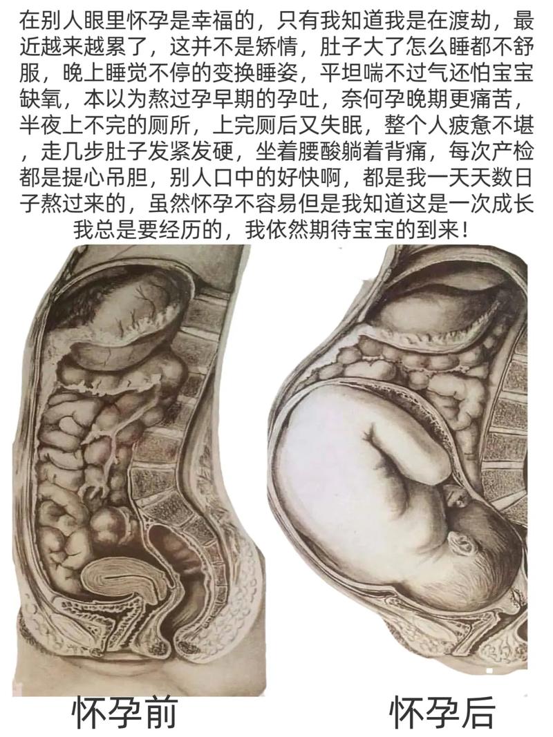 孕期下蹲真的会挤压到胎儿吗？姿势正确的话有影响吗？-第3张图片-郑州医学网