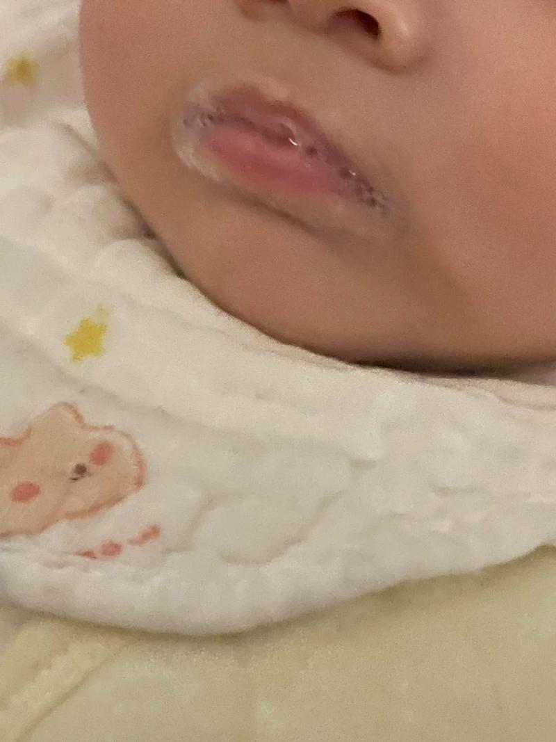 新生儿睡觉嘴巴吐泡沫是正常现象还是健康预警信号？-第1张图片-郑州医学网
