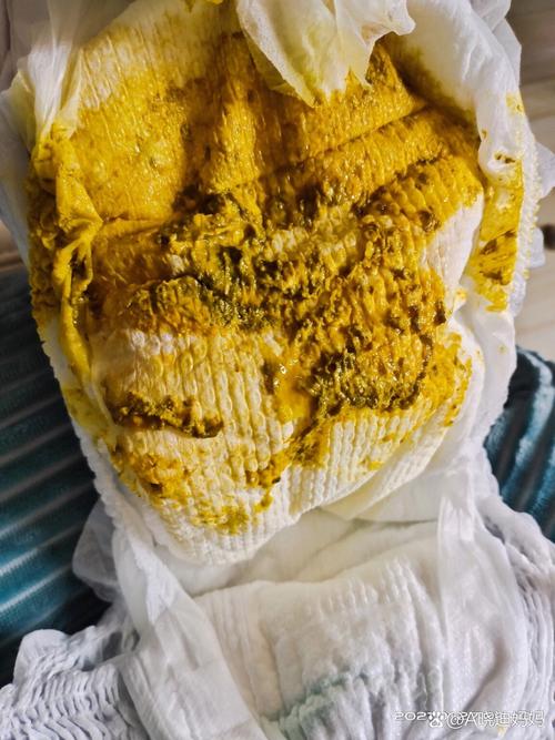 新生儿肚子咕噜响还拉稀，是消化不良还是肠炎？需要就医吗？-第2张图片-郑州医学网