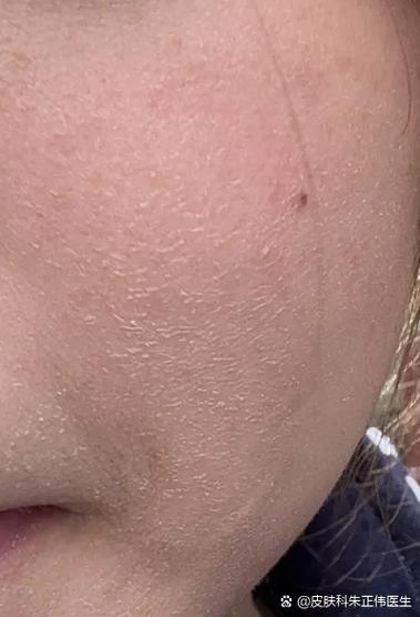 孕期皮肤变差真能预示胎儿性别是男孩吗？科学依据是什么？-第2张图片-郑州医学网