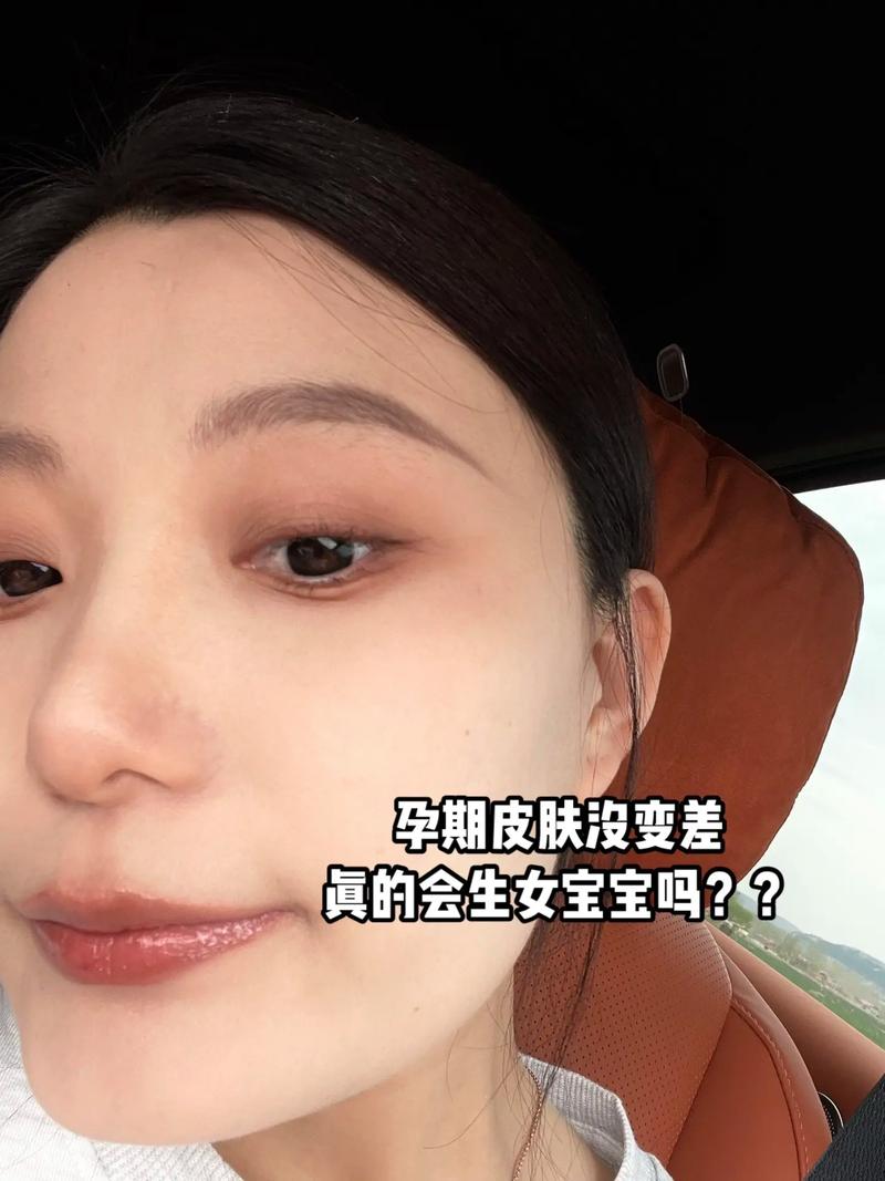 孕期皮肤变差真能预示胎儿性别是男孩吗？科学依据是什么？-第3张图片-郑州医学网