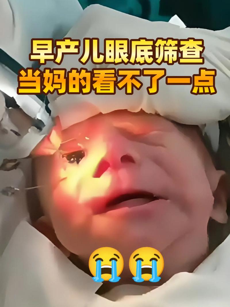新生儿眼底渗出严重吗？会不会影响视力发育，需要紧急治疗吗？-第3张图片-郑州医学网