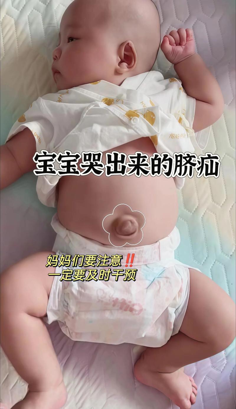 新生儿尾巴骨有眼图片是怎么回事？是先天畸形还是异常发育？-第1张图片-郑州医学网