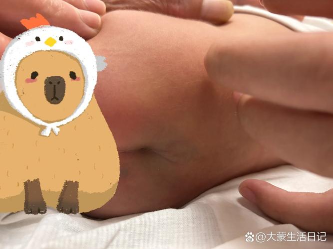 新生儿尾巴骨有眼图片是怎么回事？是先天畸形还是异常发育？-第2张图片-郑州医学网