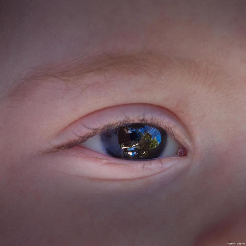 新生儿眼睛震颤是正常生理现象还是异常信号？需警惕哪些潜在病因？-第3张图片-郑州医学网