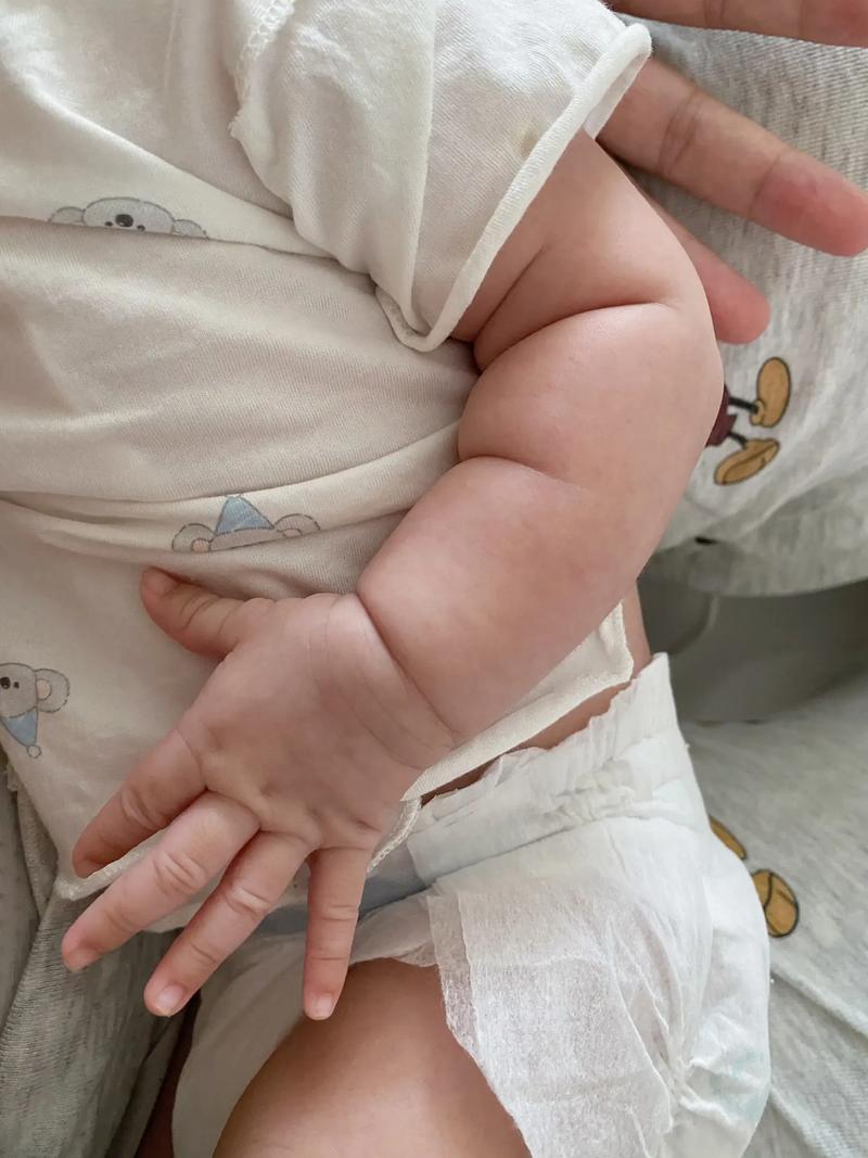 新生儿胳膊上种花图片-第1张图片-郑州医学网