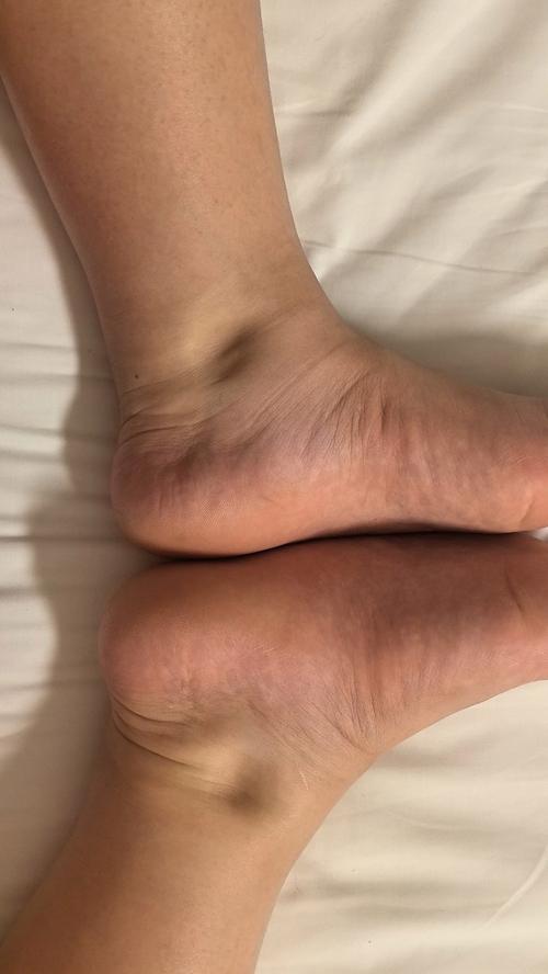 孕期足月无疼痛感却突然有水流出，这是破水还是正常分泌物？需要立即就医吗？-第3张图片-郑州医学网